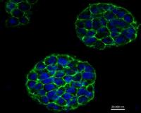 Engineering Breakthrough Will Allow Cancer Researchers to Create Live Tumors With a 3D Printer