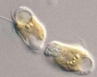 Researchers Identify What Makes Deadly Algae More Toxic