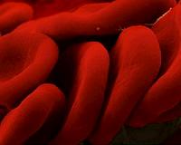 Major limitations found with nanotubes in blood facing medical devices