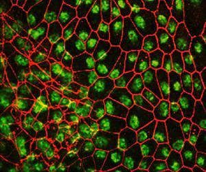 IUPUI Stem Cell Research Could Expand Clinical Use of Regenerative Human Cells