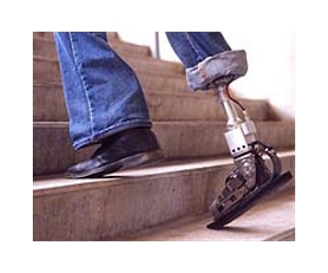 Farmers tough on artificial limbs