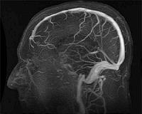 Study: Brain scans could predict future behavior