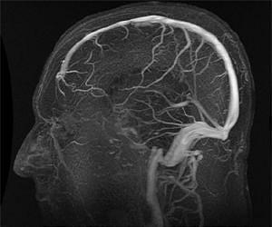 Chips that mimic the brain
