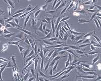 Microgravity conditions affect DNA methylation of muscle cells, slowing their differentiation