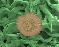 Peppermint oil and cinnamon could help treat and heal chronic wounds