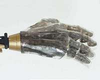 New tech may make prosthetic hands easier for patients to use