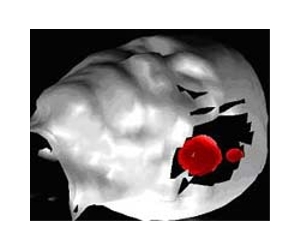 Researchers Find How Brain Hears The Sound Of Silence