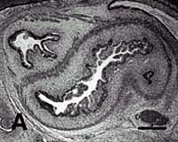 Adult stem cells revert to embryonic state