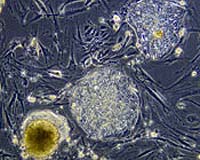 10th anniversary of stem cell era