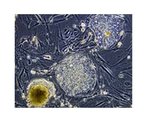 Early embryos can correct genetic abnormalities during development