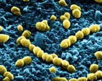 Research Could Put Penicillin Back In Battle Against Antibiotic Resistant Bugs That Kill Millions
