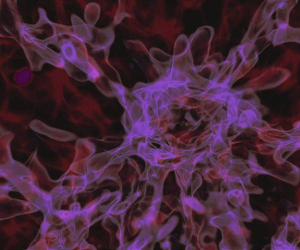 Will this solve the mystery of the expansion of the universe