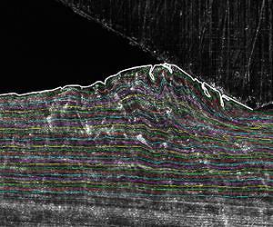 Sliding metals show fluidlike behavior, new clues to wear