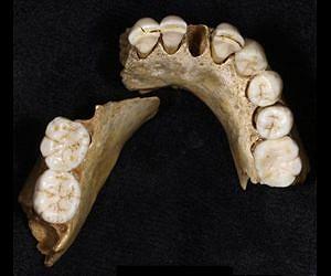 The evolutionary origins of our pretty smile