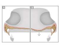 Ancient amphibian had mouthful of teeth ready to grab you
