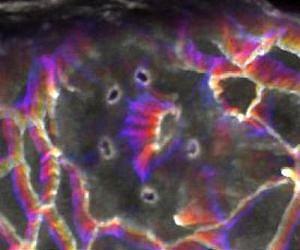 Using lasers to vaporize tissue at multiple points simultaneously
