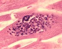 Salmon parasite is world's first non-oxygen breathing animal