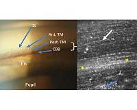 Telescope technology used to take first accurate images of glaucoma-related eye structure