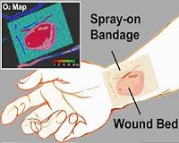 'Smart' bandage emits phosphorescent glow for healing below