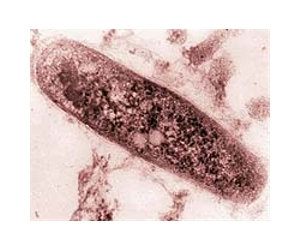Einstein Researchers Discover Two New Ways To Kill TB