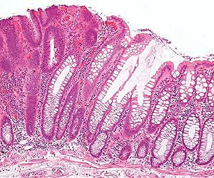 Discovery of earliest life forms' operation promises new therapies for key diseases