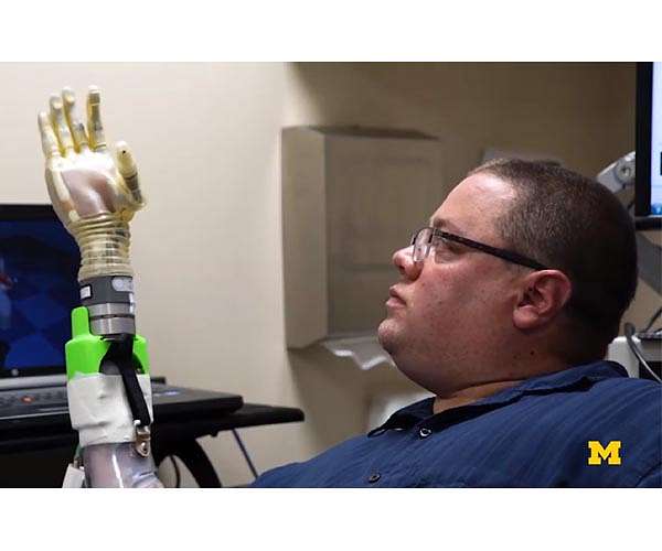 New surgery may enable better control of prosthetic limbs