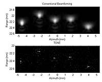 Researchers Develop Tool For Clearer Ultrasound Images
