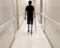 Type And Severity Of Combat Wounds In Iraq War Have Changed Over Time