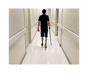New limbs aid Syrians in long walk back from war