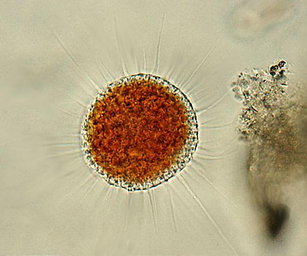 Texas on alert after brain-eating amoeba kills boy, 6