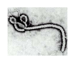 New Tool Detects Ebola, Marburg Quickly