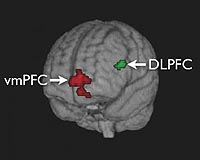 Caltech Researchers Pinpoint The Mechanisms Of Self-Control In The Brain