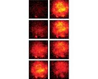 Sensor sees nerve action as it happens
