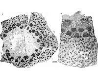 Fossils from the world's oldest trees reveal complex anatomy never seen before
